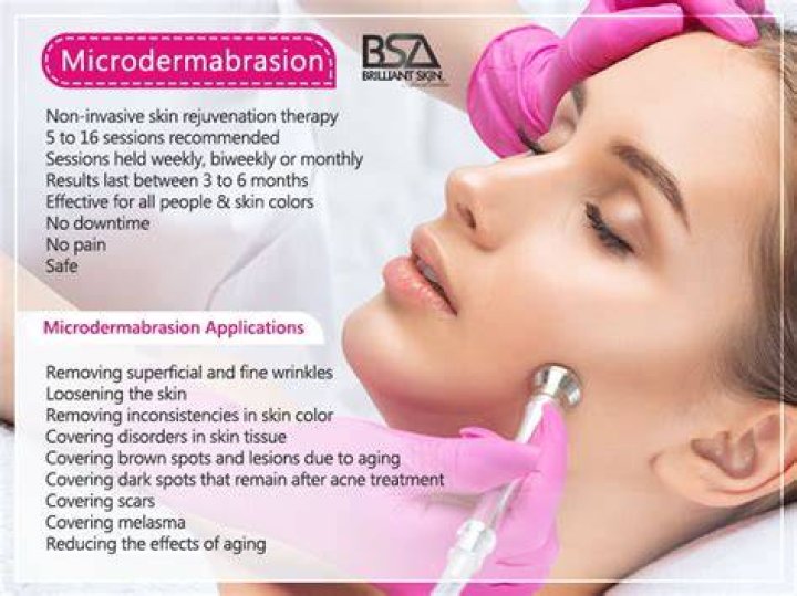 What should you not do after a microdermabrasion?